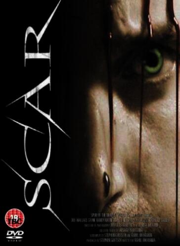 Scar