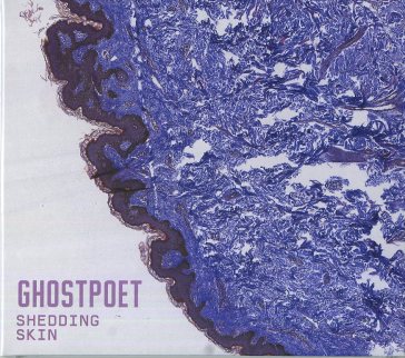 Shedding skin