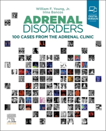  Adrenal Disorders    -0