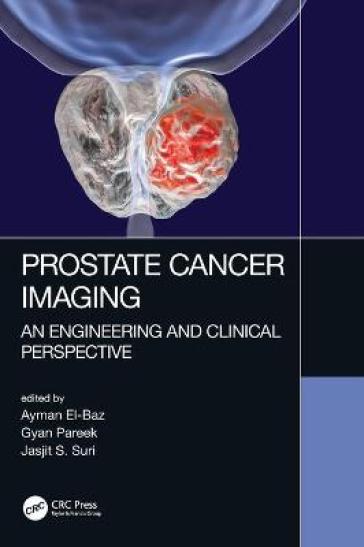 Prostate Cancer Imaging