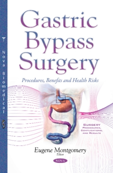 Gastric Bypass Surgery