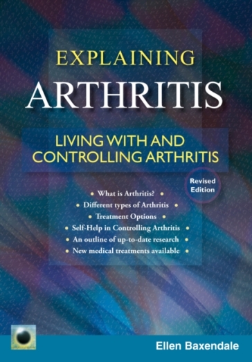 An Emerald Guide to Explaining Arthritis