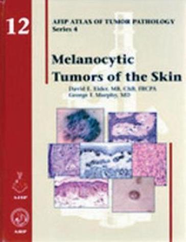 Melanocytic Tumors of the Skin