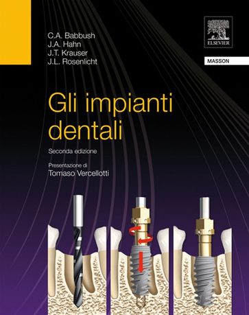Gli impianti dentali