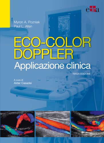 Eco-color Doppler