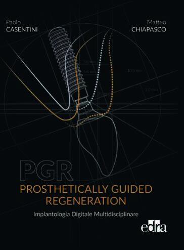 PGR. Prosthetically guided regeneration. Implantologia Digitale Multidisciplinare