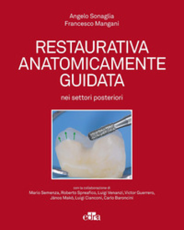 Restaurativa anatomicamente guidata nei settori posteriori