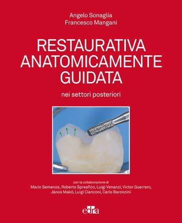 Restaurativa anatomicamente guidata nei settori posteriori