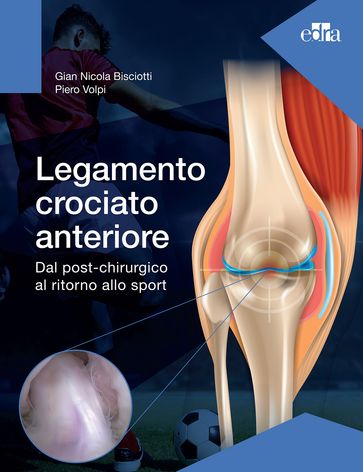 Legamento crociato anteriore