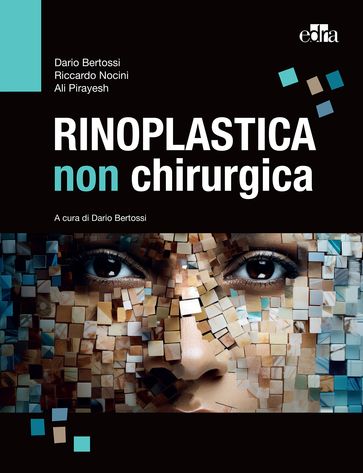 Rinoplastica non chirurgica