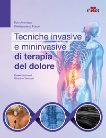 Tecniche invasive e mininvasive di terapia del dolore