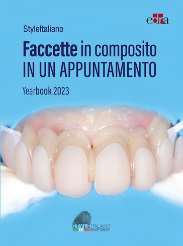 Faccette in composito in un appuntamento