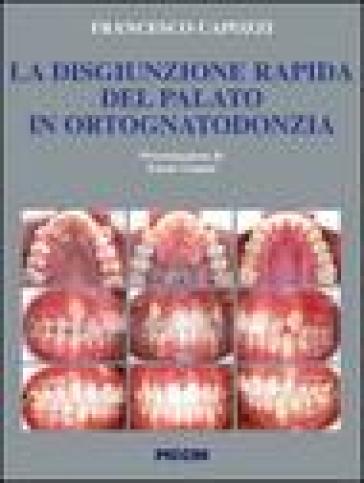 La disgiunzione rapida del palato in ortognatodonzia