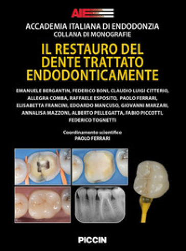 Il restauro del dente trattato endodonticamente