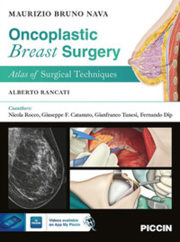 Oncoplastic breast surgery. Atlas of surgical techniques