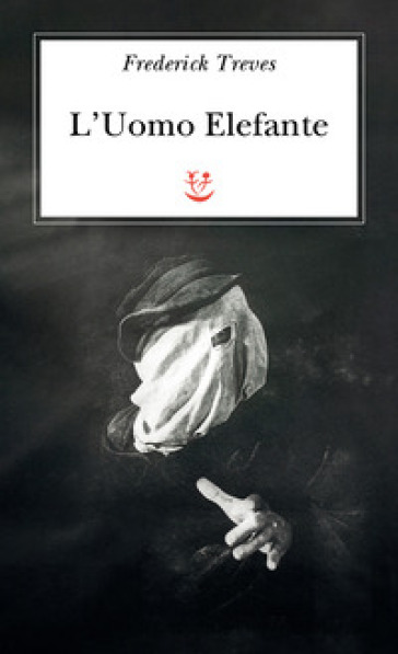 L'uomo elefante