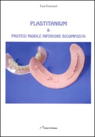 Plastitanium &amp; protesi mobile inferiore bicomposta