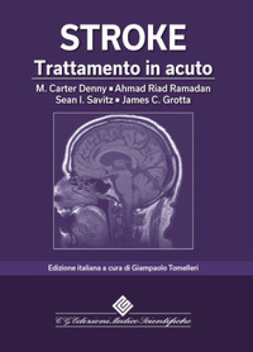 Stroke. Trattamento in acuto