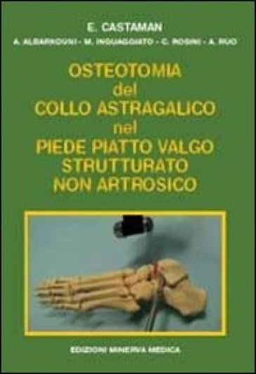 Osteotomia Del Collo Astragalico Nel Piede Piatto Valgo Strutturato Non Artrosico
