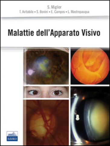 Malattie dell'apparato visivo