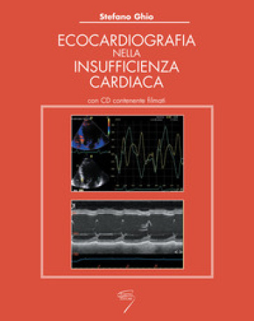 Ecocardiografia nell'insufficienza cardiaca. Con CD-ROM