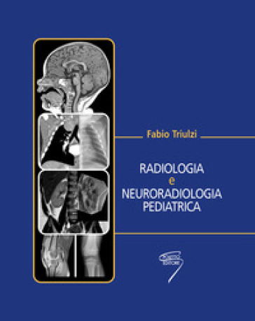 Radiologia E Neuroradiologia Pediatrica