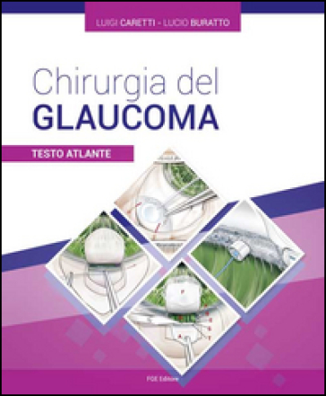 Chirurgia del glaucoma. Testo atlante
