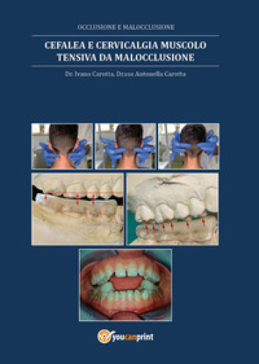 Cefalea e cervicalgia muscolo tensiva da malocclusione