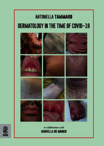 Dermatology in the time of Covid-19
