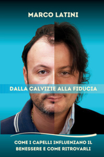 Dalla calvizie alla fiducia. Come i capelli influenzano il benessere e come ritrovarli