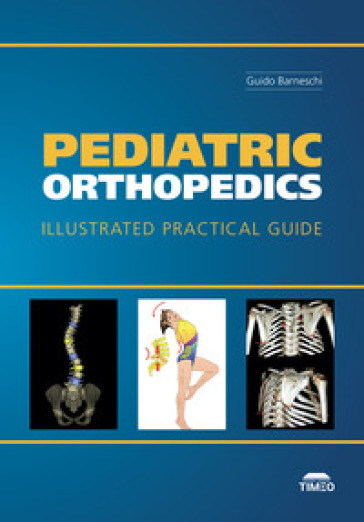 Pediatric Orthopedics. Illustrated Practical Guide. Ediz. illustrata