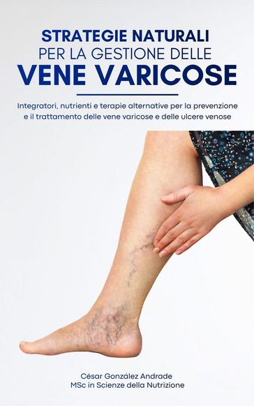 Strategie naturali per la gestione delle vene varicose